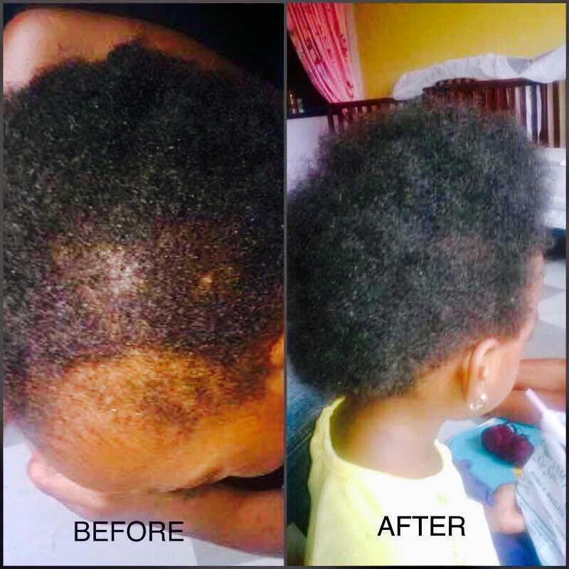 Product Review + Client's Results – Wura's Secret Hair Growth Oil - Wura's  Secret